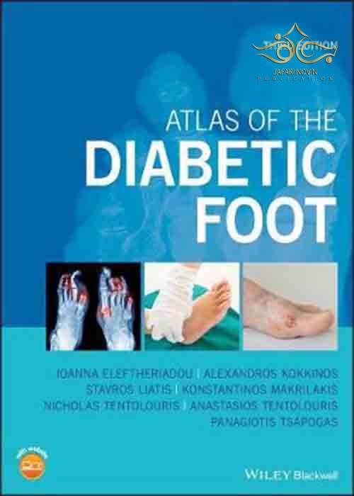 Atlas of the Diabetic Foot 3rd Edition John Wiley-Sons